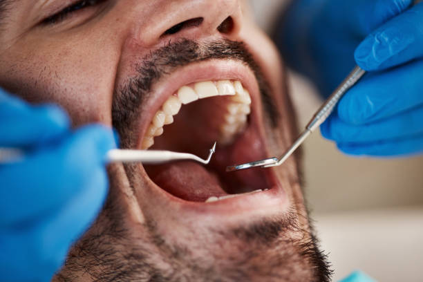 Best Chipped Tooth Repair Near Me  in Churchville, PA